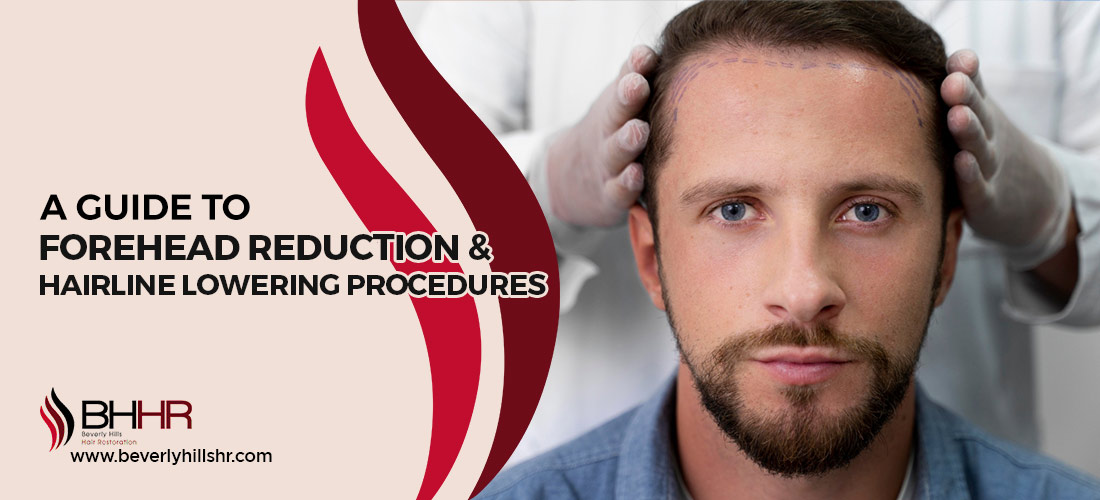 Hairline Hair Transplant Procedures 