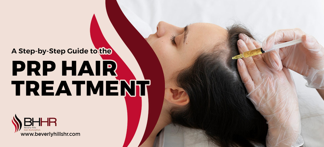 PRP hair treatment procedure