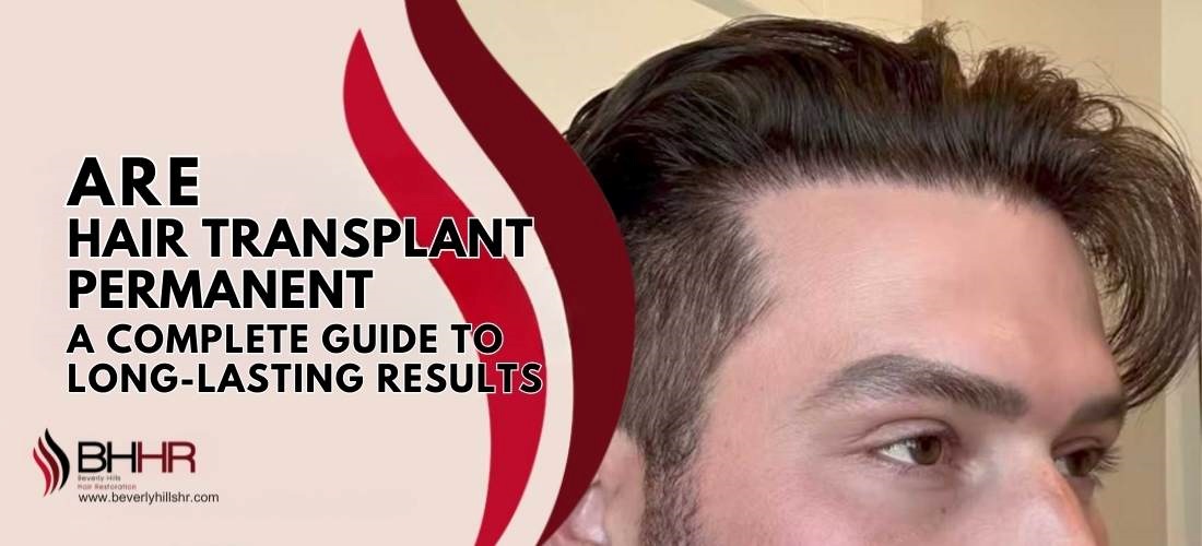Are Hair Transplants Permanent