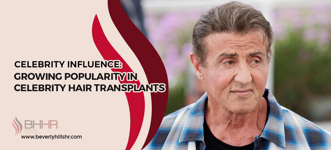 Celebrity Transplants