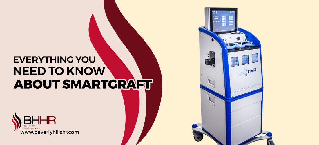 SmartGraft 