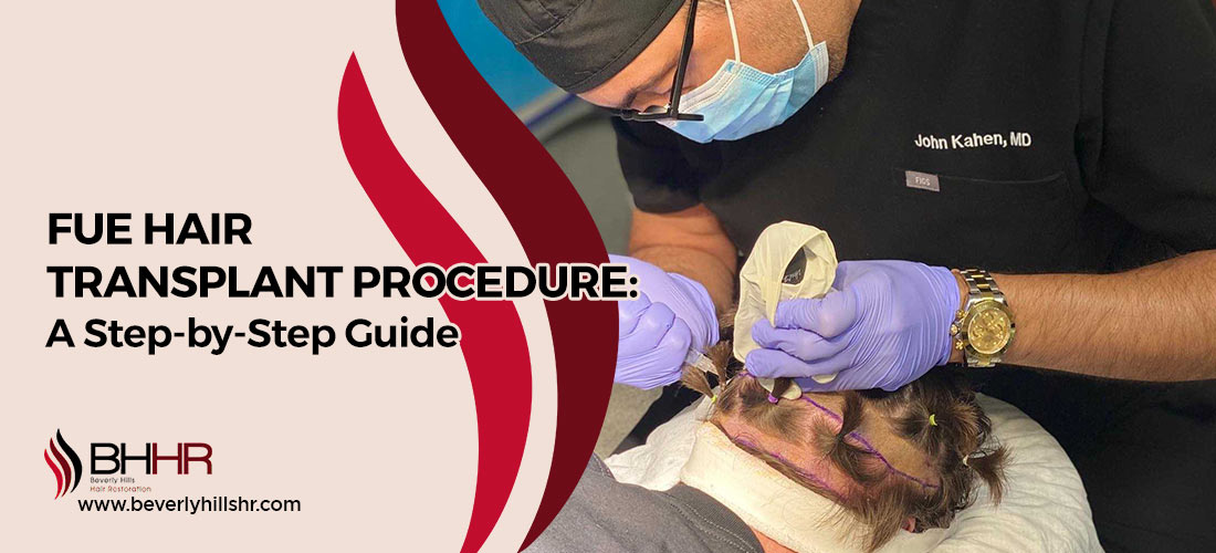 FUE Hair Transplant Procedure