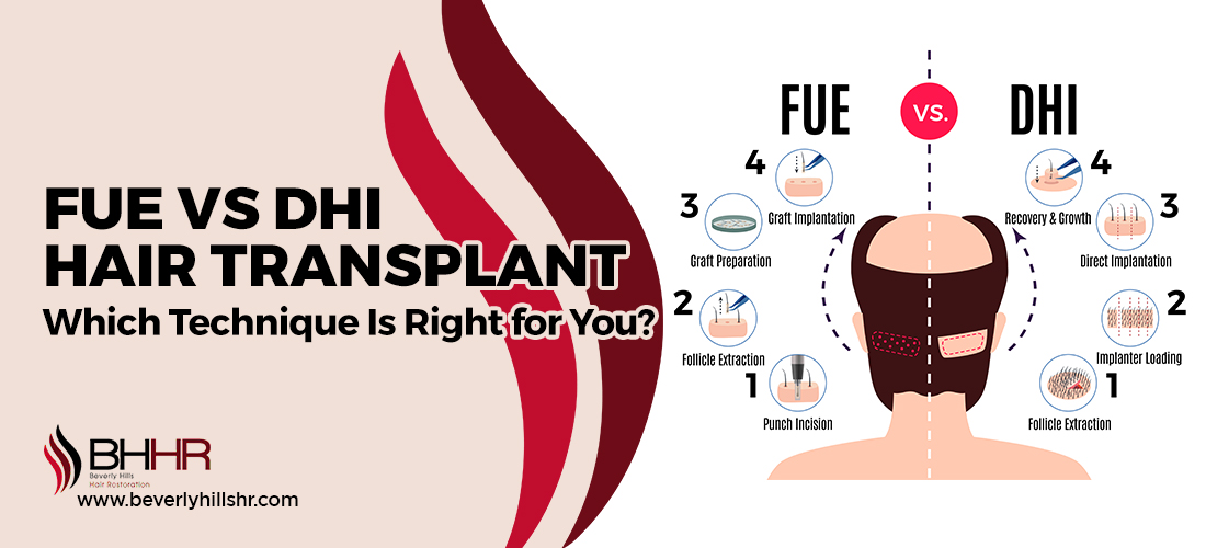 FUE vs DHI Hair Transplant