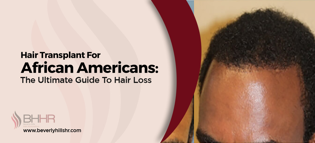 Hair Transplant African American 