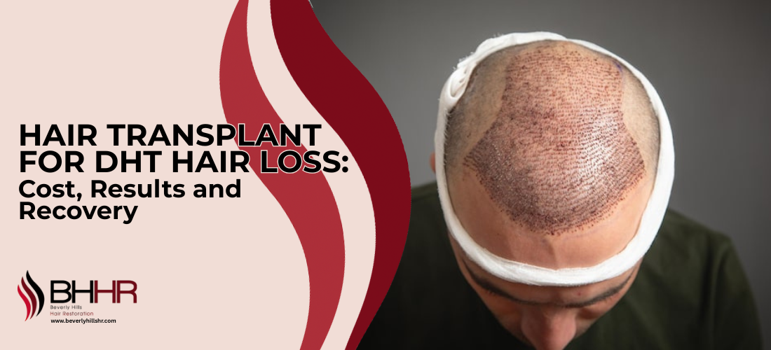 Hair Transplant for DHT Hair Loss