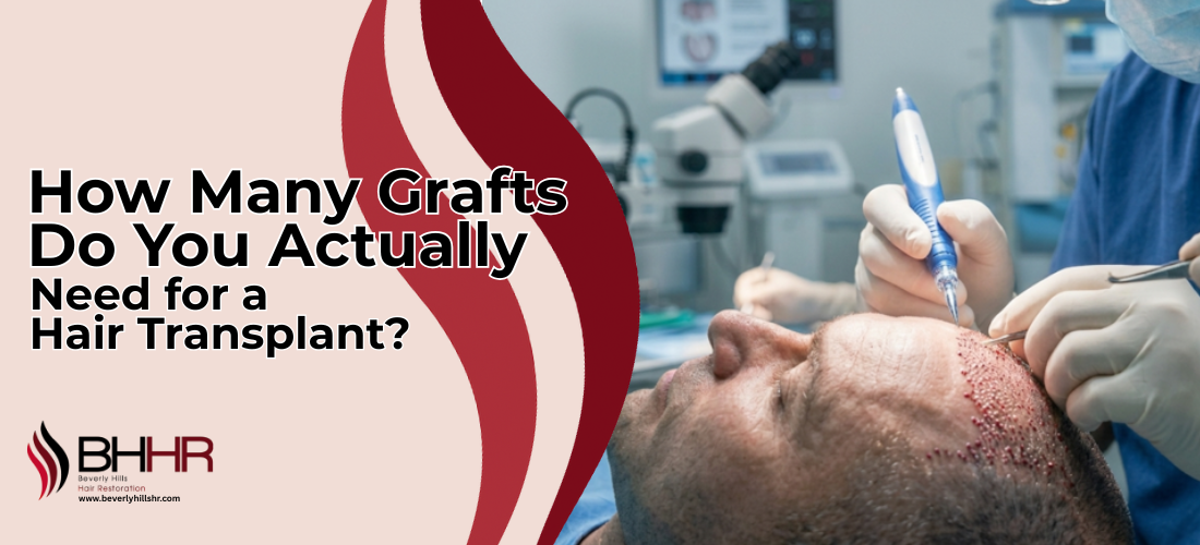 How Many Hair Grafts Do I Need
