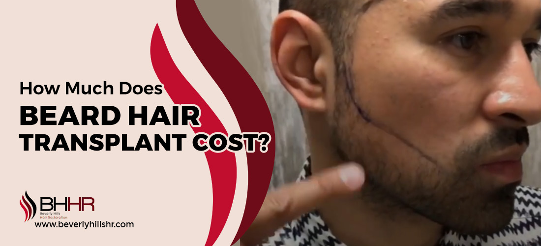 Beard Hair Transplant Cost