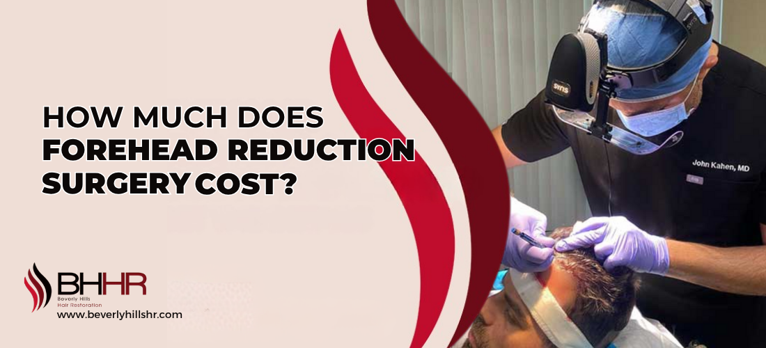 Forehead Reduction Surgery Cost