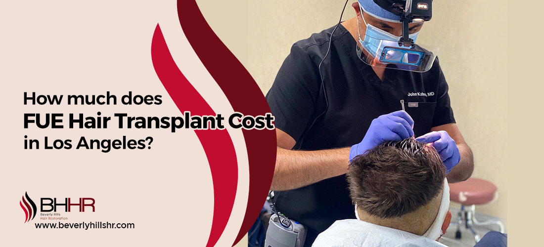 FUE Hair Transplant Cost