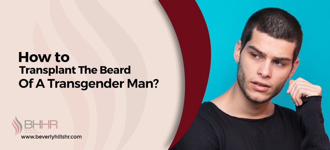 transgender facial hair