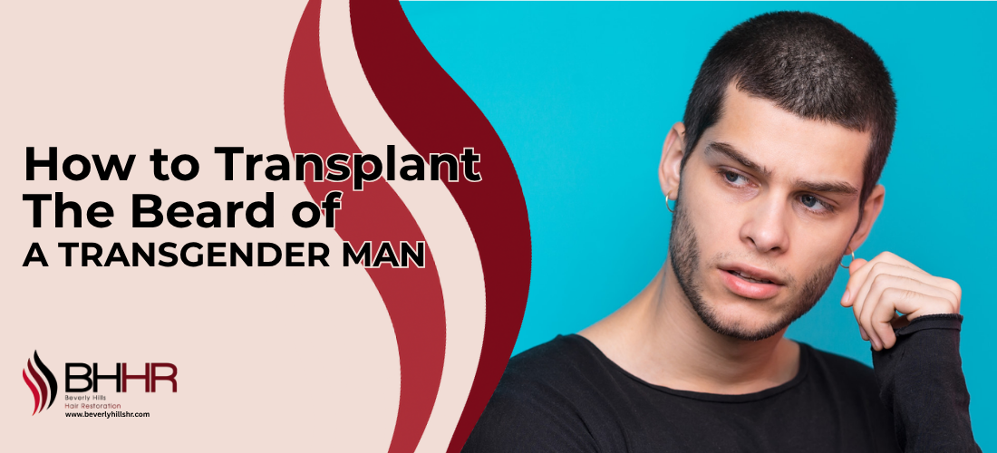 transgender facial hair