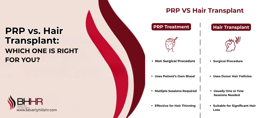 PRP vs. Hair Transplant