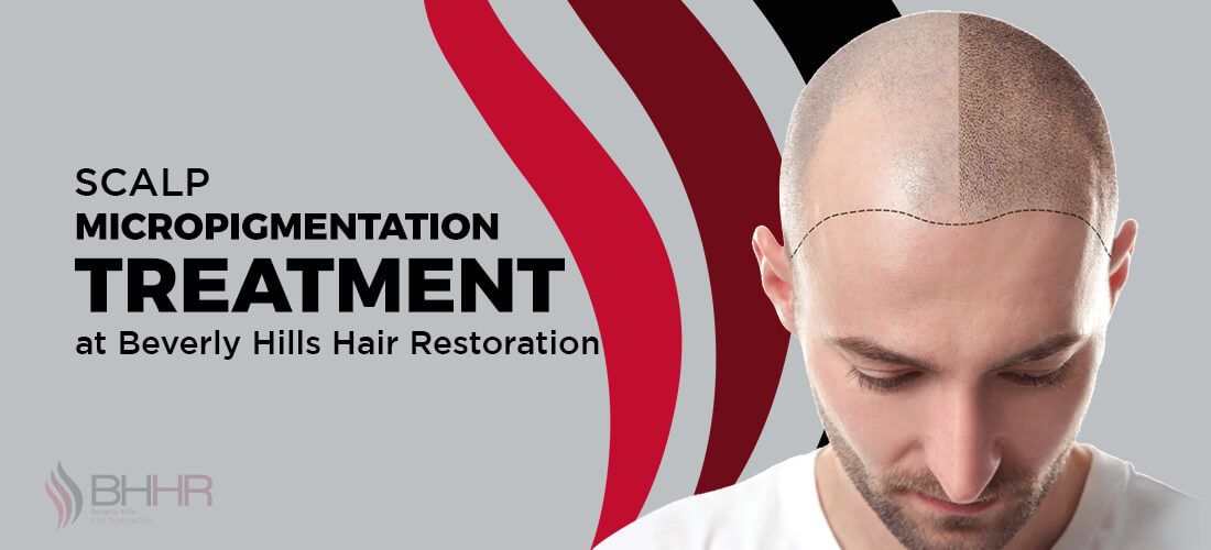 scalp micropigmentation in BHHR