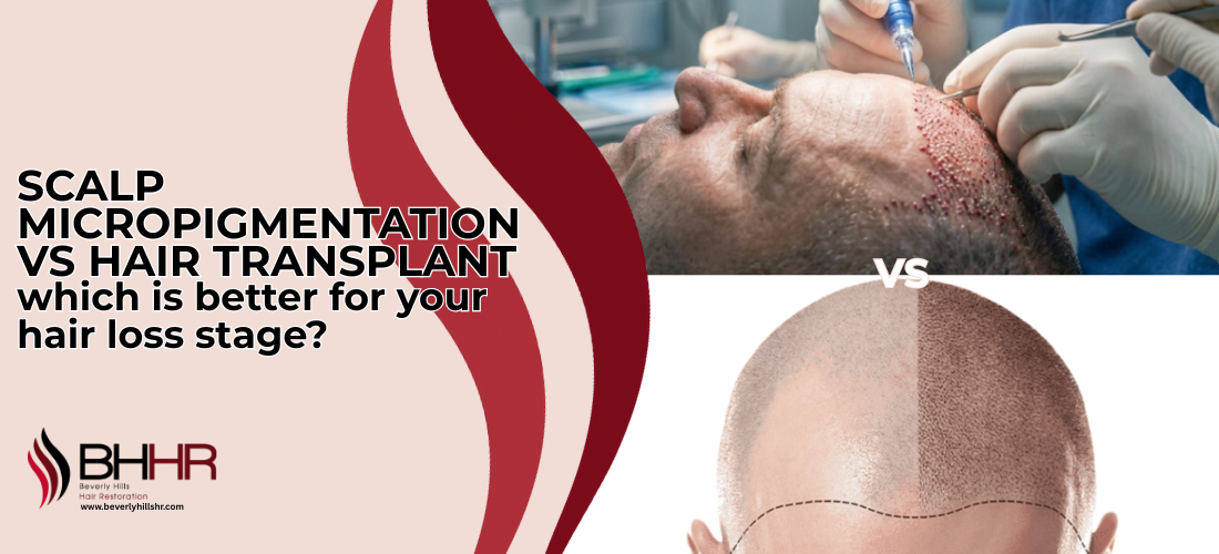 Scalp Micropigmentation vs Hair Transplant