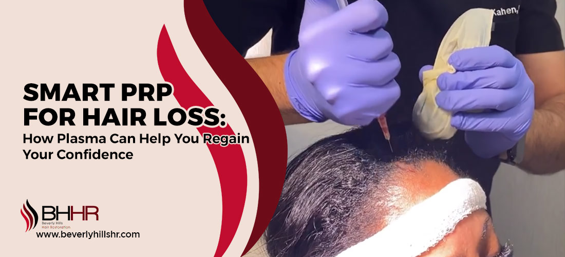 smart prp for hair loss