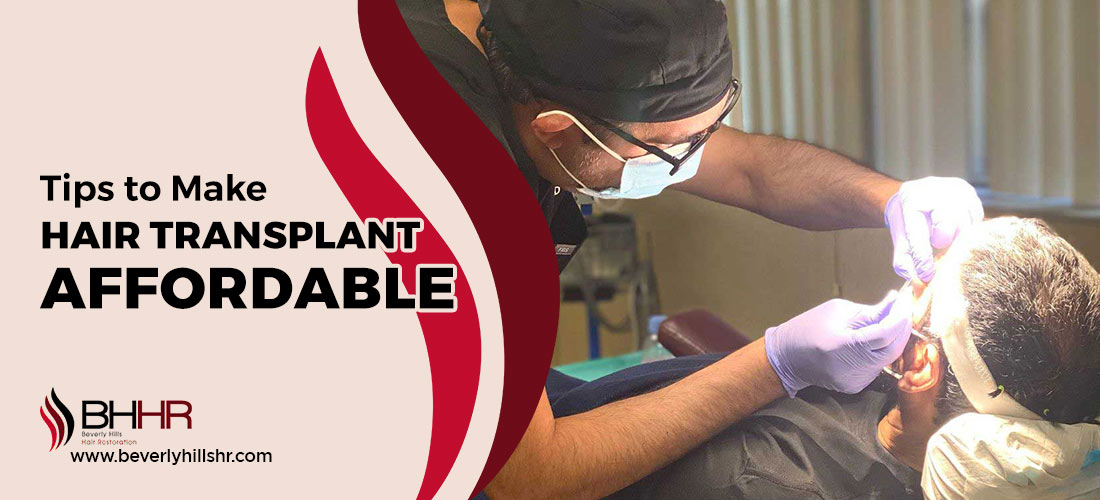 Affordable hair transplant
