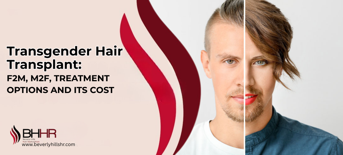 transgender hair transplant