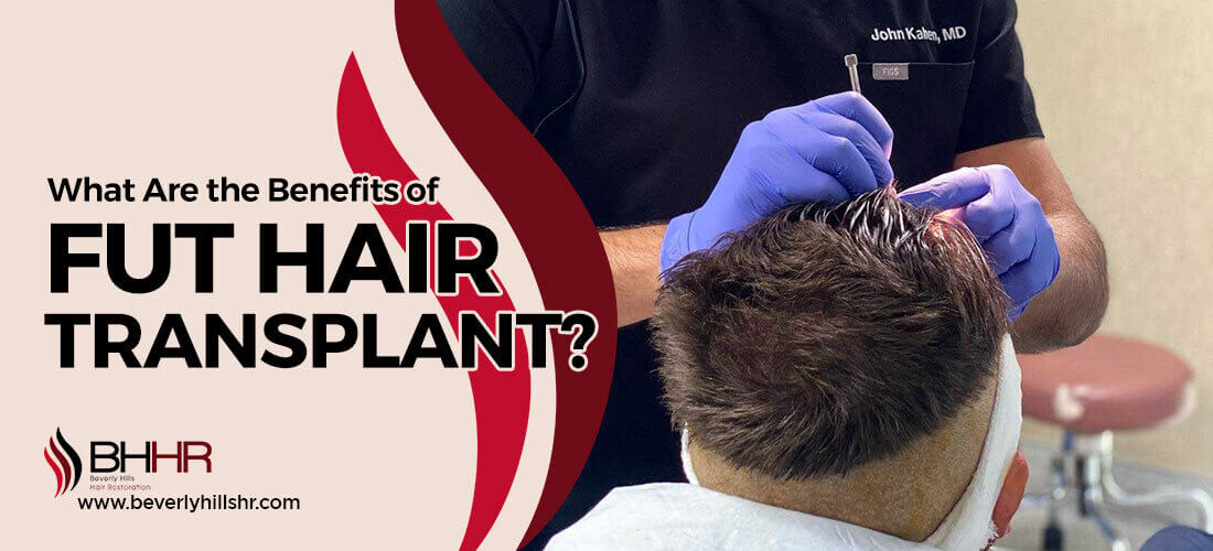 fut hair transplant benefits