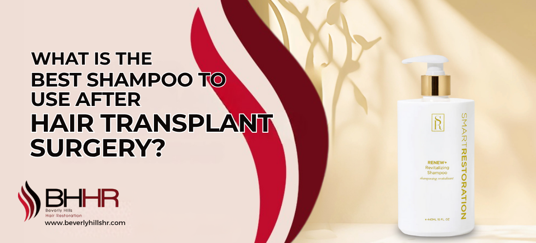 Best shampoo after hair transplant 