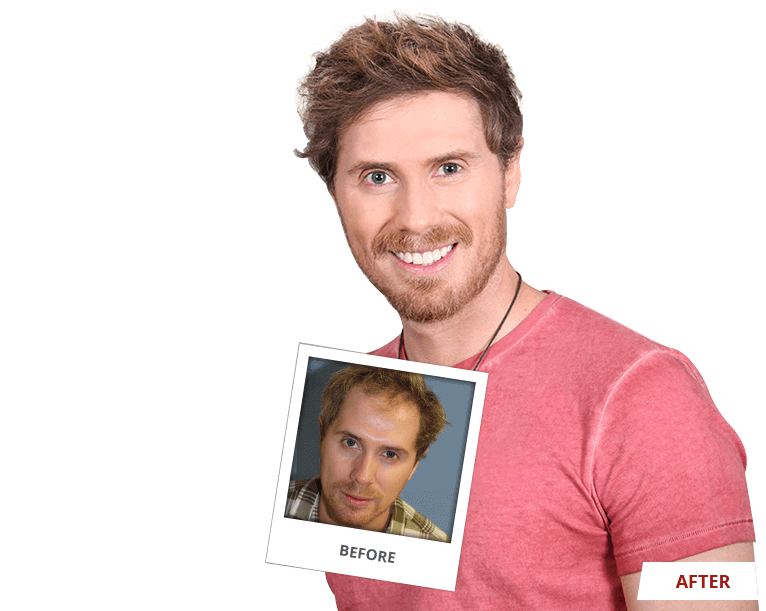 award-winning-transformations